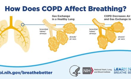 Managing the Price of Bronchial asthma and COPD Inhalers